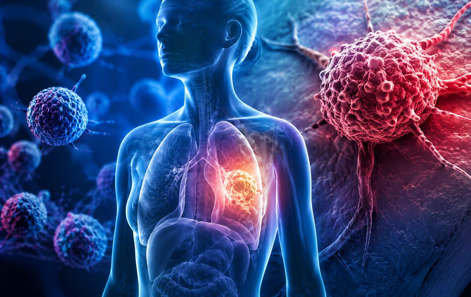 Millions of Cancer Cases Could Be Avoided Through Lifestyle Changes